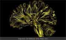 neurones less intelligences simulées